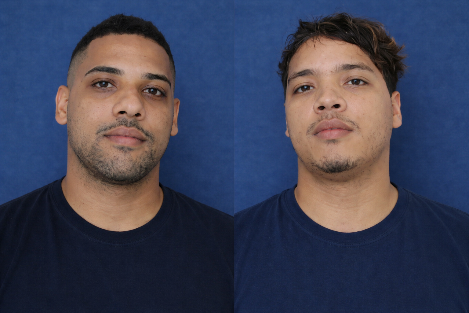 Confronto com o GTO termina com dois suspeitos mortos em Assú