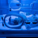 Falta de tratamento para icterícia neonatal na rede pública faz MPRN acionar a Justiça em Pau dos Ferros